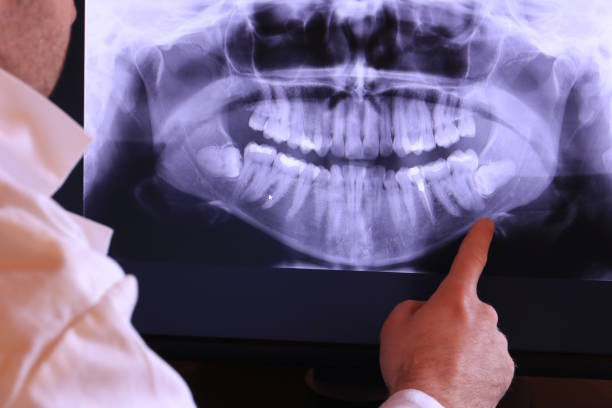 Best Emergency Dental Care for Sports Injuries in St Paul, MO
