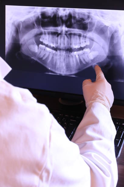 Best Knocked-Out Tooth (Avulsed Tooth) Treatment in St Paul, MO