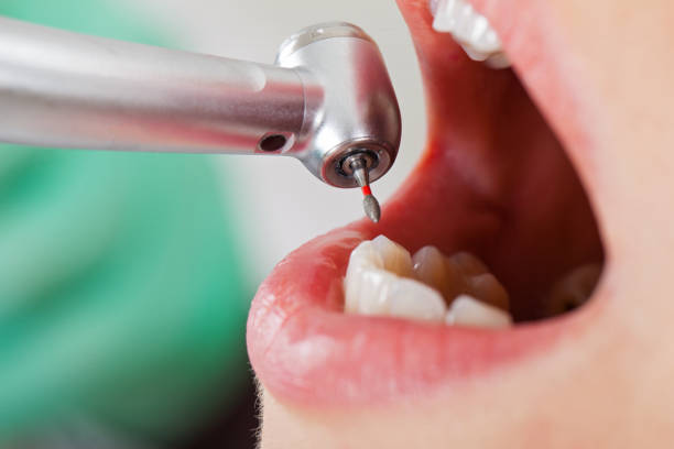 Professional Emergency Dental Service in MO